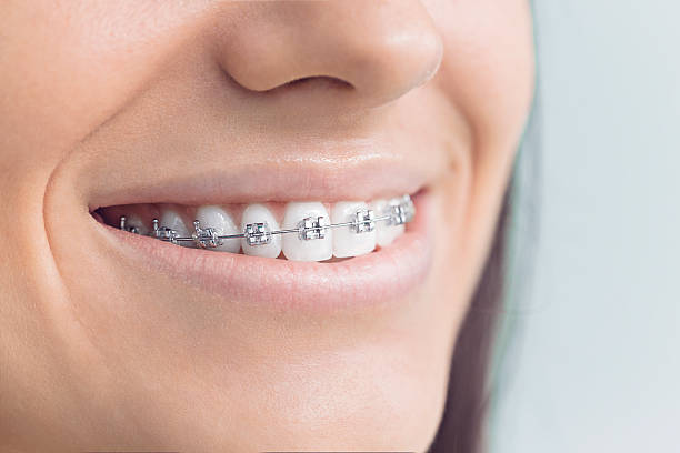Best Full Mouth Reconstruction  in Willoughby Hills, OH